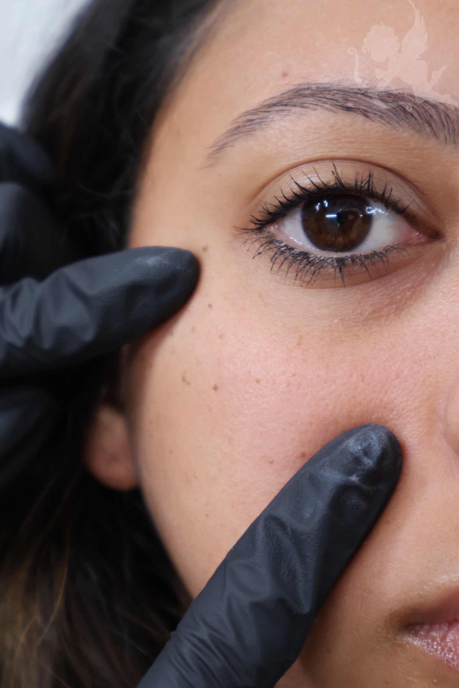 Rejuran PDRN skin healing