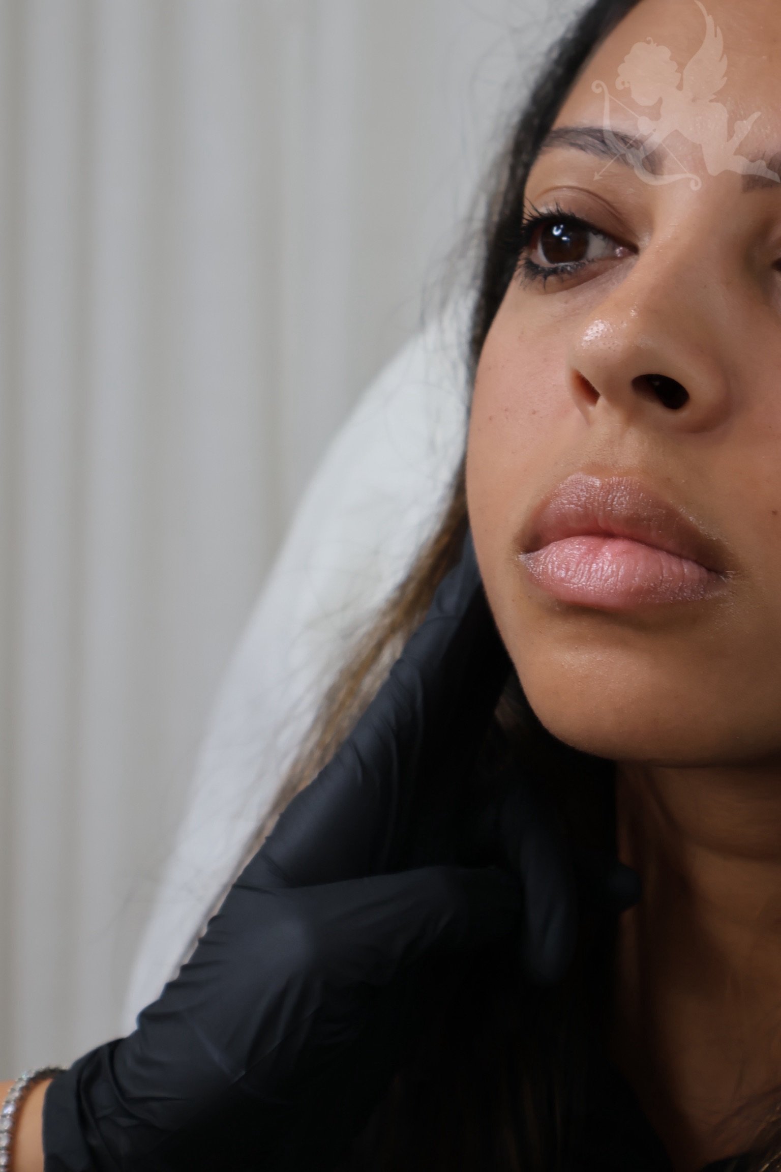 Bio remodelling skin treatment