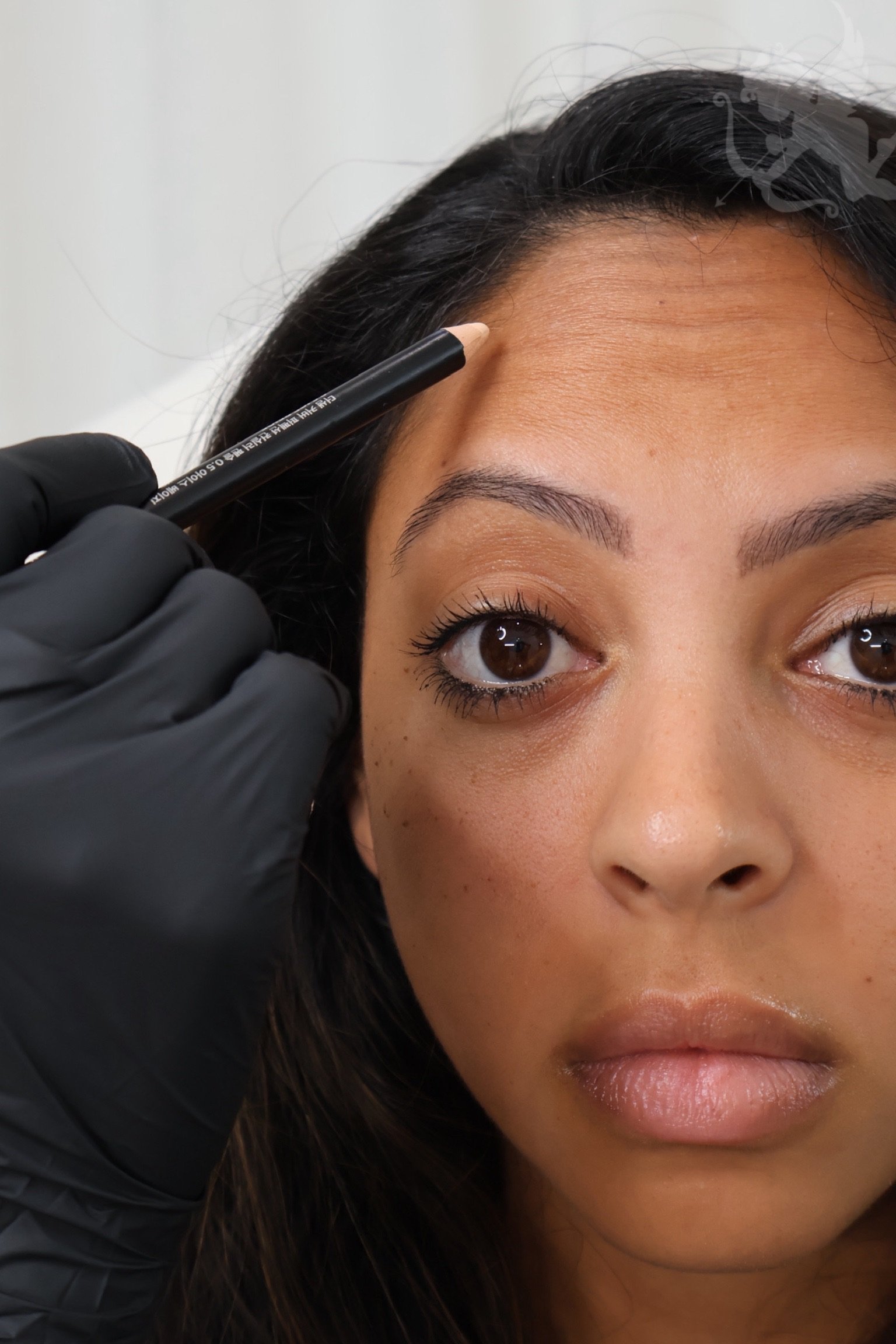 Thread lift facial mapping