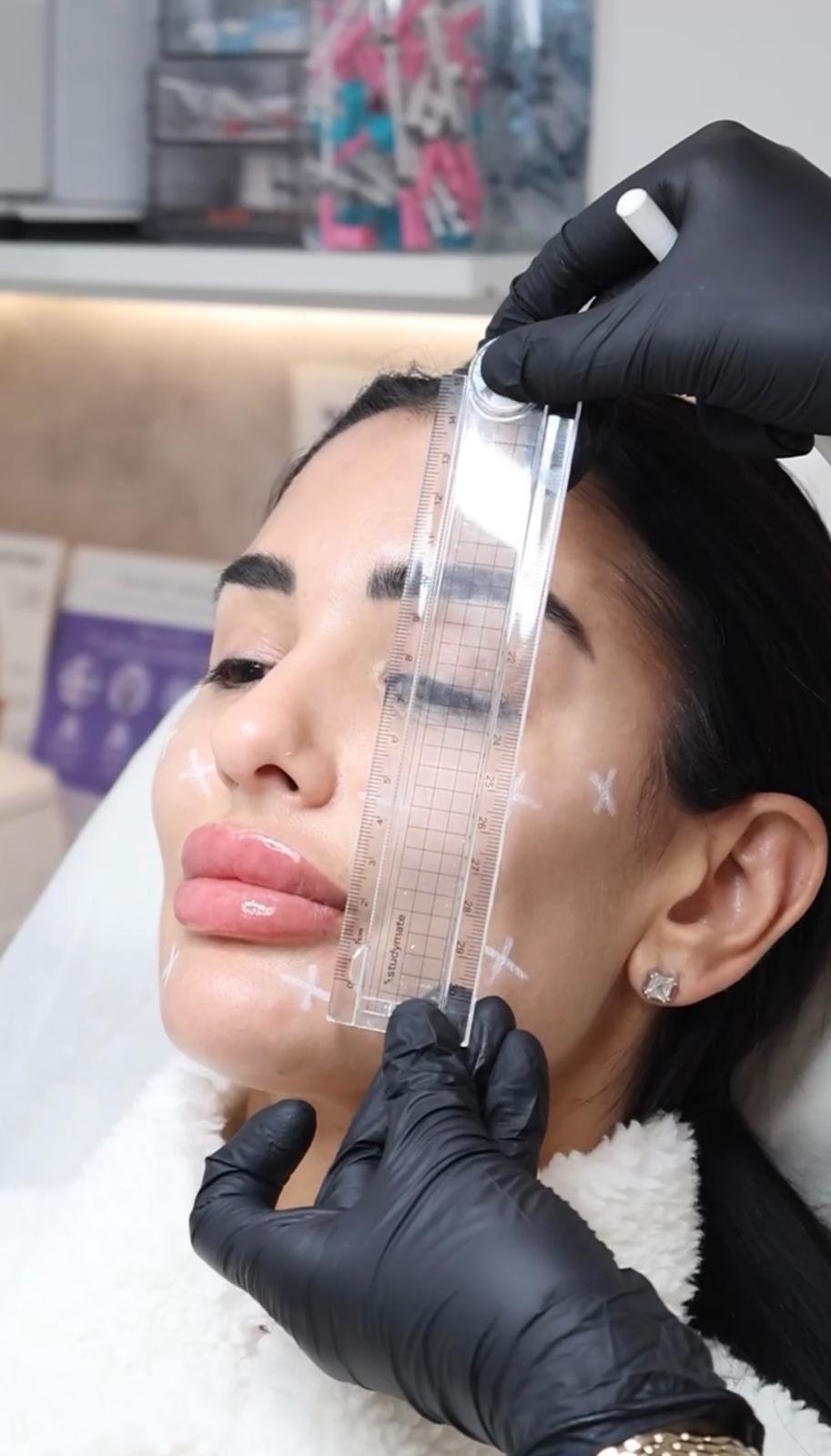 Bio remodelling skin treatment