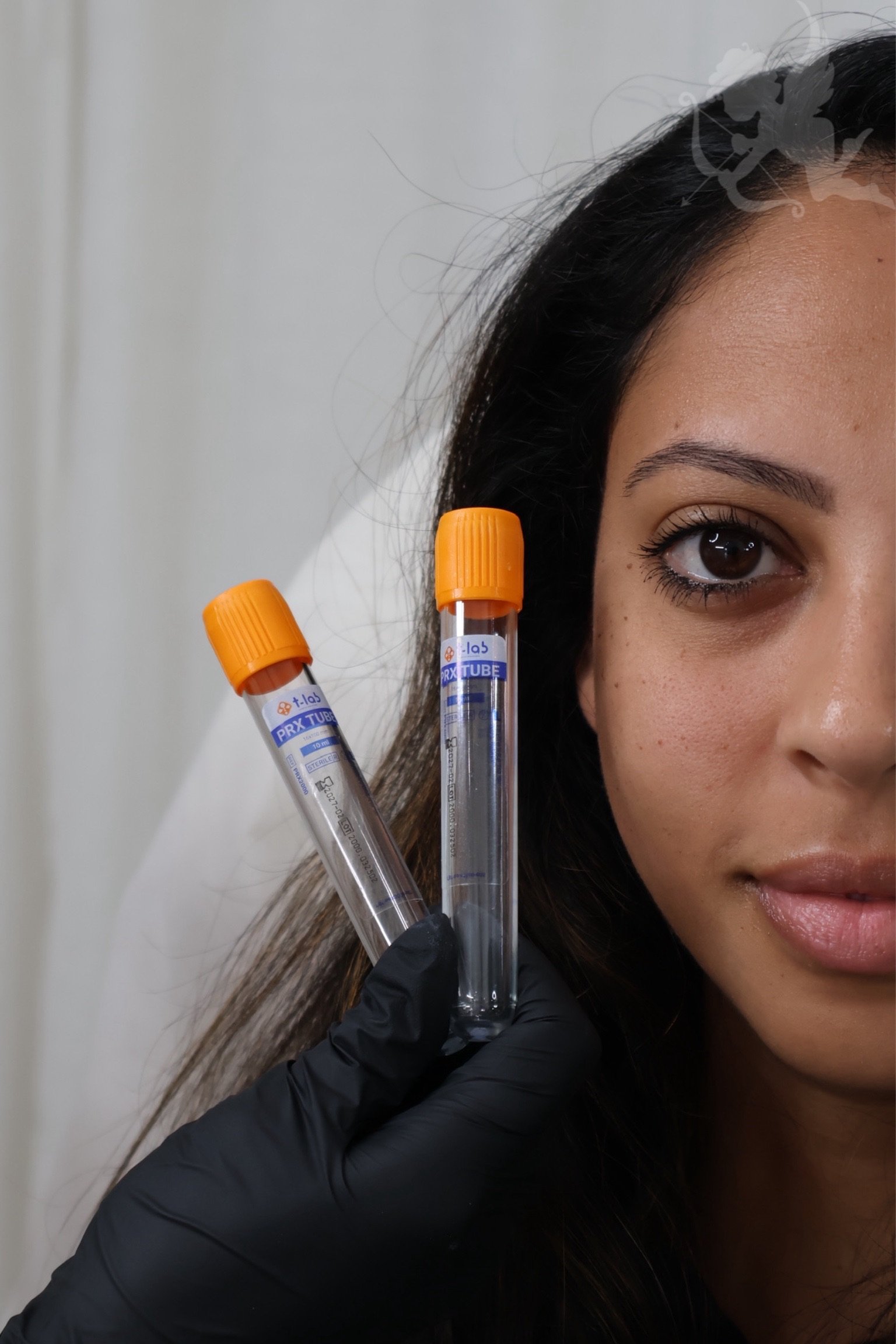 PRP PRF therapy at Angelic Cosmetic Clinic, Kogarah NSW